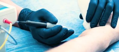 Clinica Balance electrolisis 4