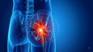 Ubicación del dolor en sindrome piramidal